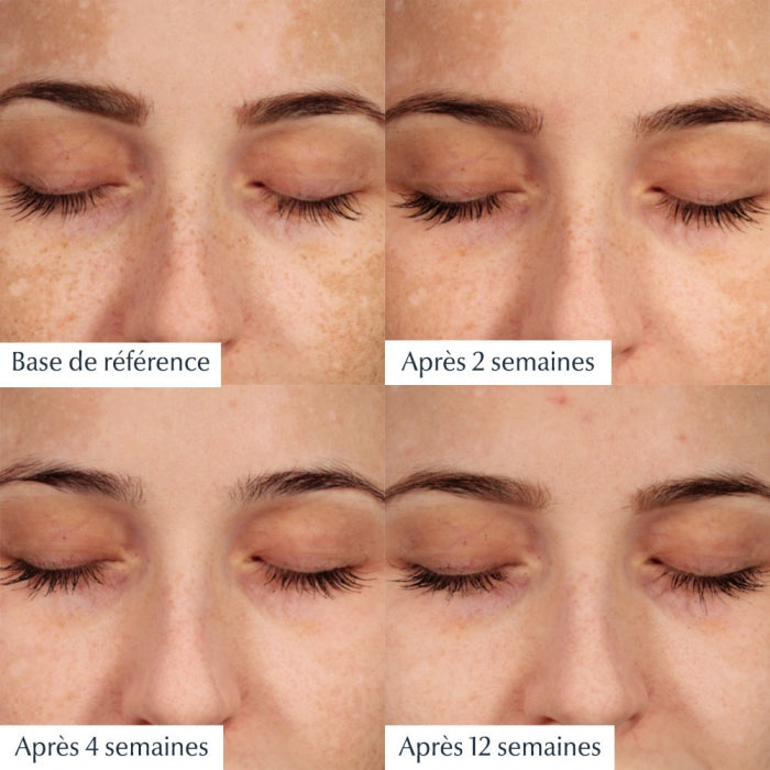 leucerin-anti-pigment-serum-duo-50ml