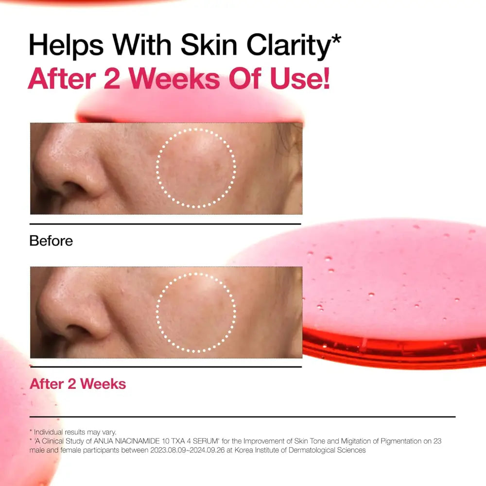 ANUA Niacinamide 10% + TXA 4% Dark Spot Correcting Serum 30ml masques