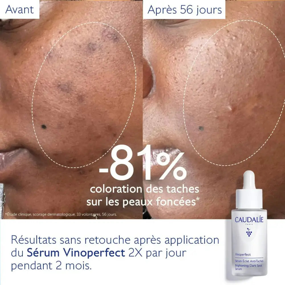 CAUDALIE New Vinoperfect Sérum Éclat Anti Taches 30ml