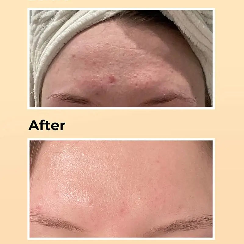 cosrx-essance-a-la-mucine-descargot-advanced-snail-96-mucine-power-100ml