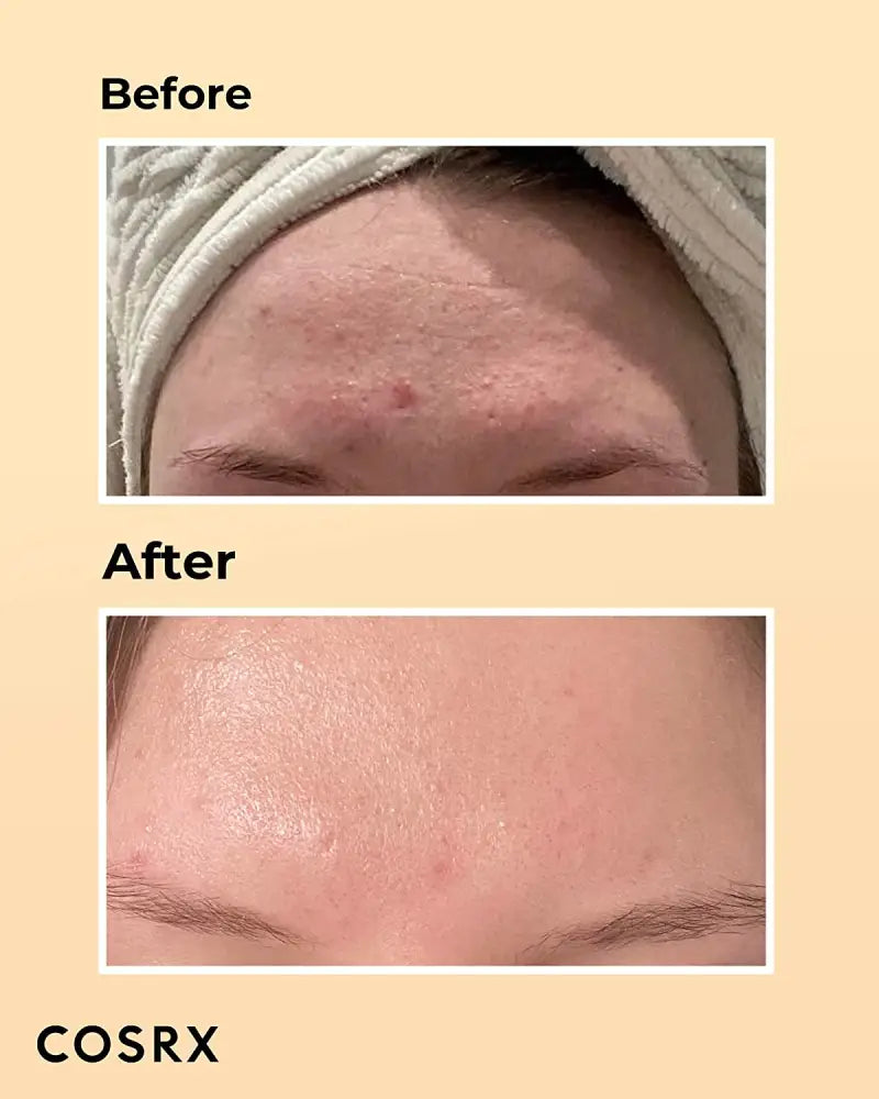 cosrx-essance-a-la-mucine-descargot-advanced-snail-96-mucine-power-100ml