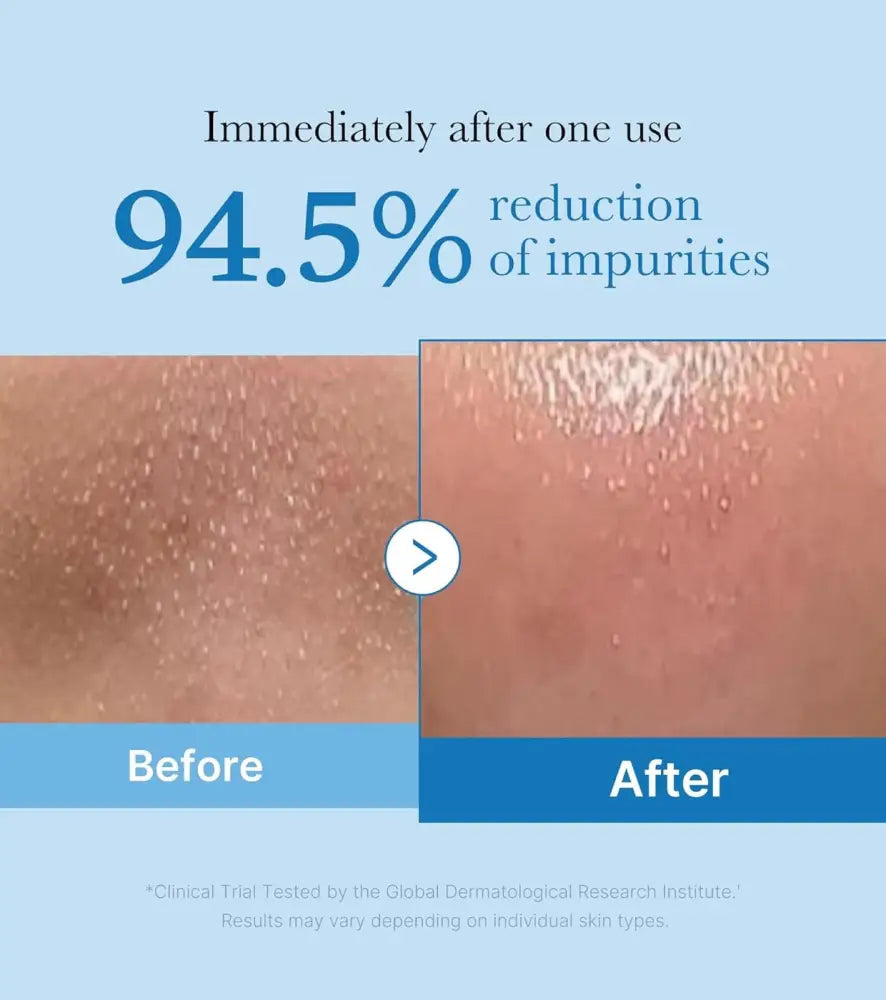 MEDICUBE - DUO Double Cleansing Zero Foam Cleanser + Zero Pore Blackhead Deep Cleansing Oil (2pcs) masques