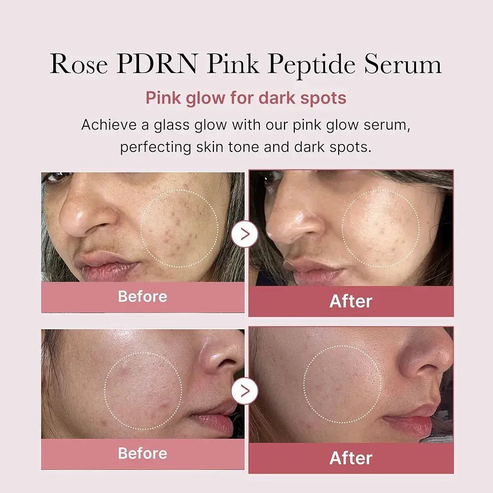 MEDICUBE PDRN Pink Peptide Serum 30ml masques