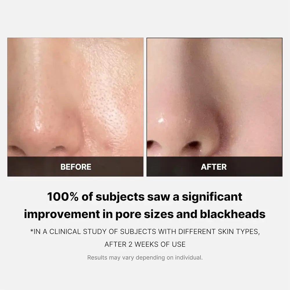MEDICUBE Zero Pore Pad 2.0 70 pads masques
