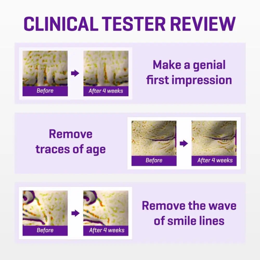 SOME BY MI Retinol Intense Advanced Triple Action Eye Cream 30ml