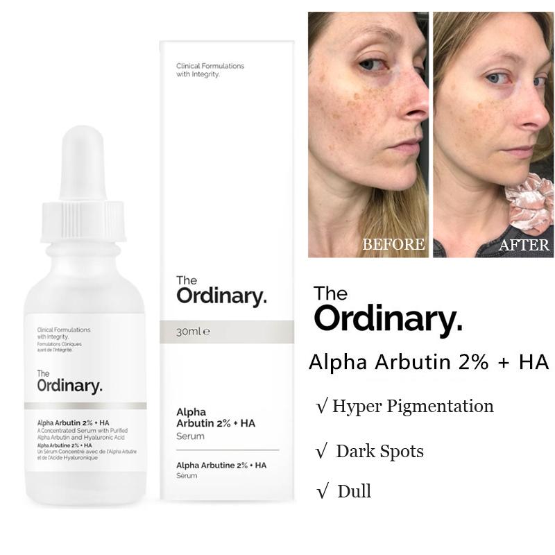 the-ordinary-alpha-arbutine-2-haserum-anti-hyper-pigmentation-30ml