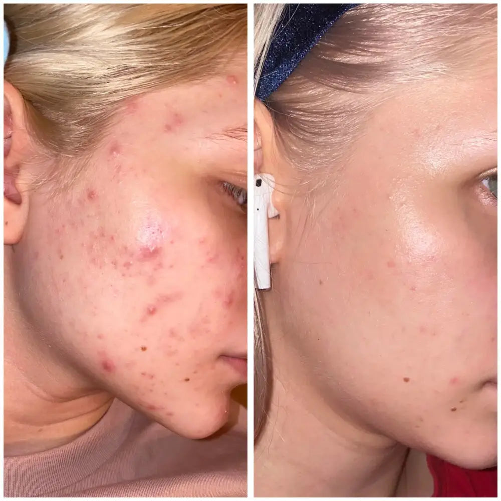 the-ordinary-hyaluronic-acid-2-b5