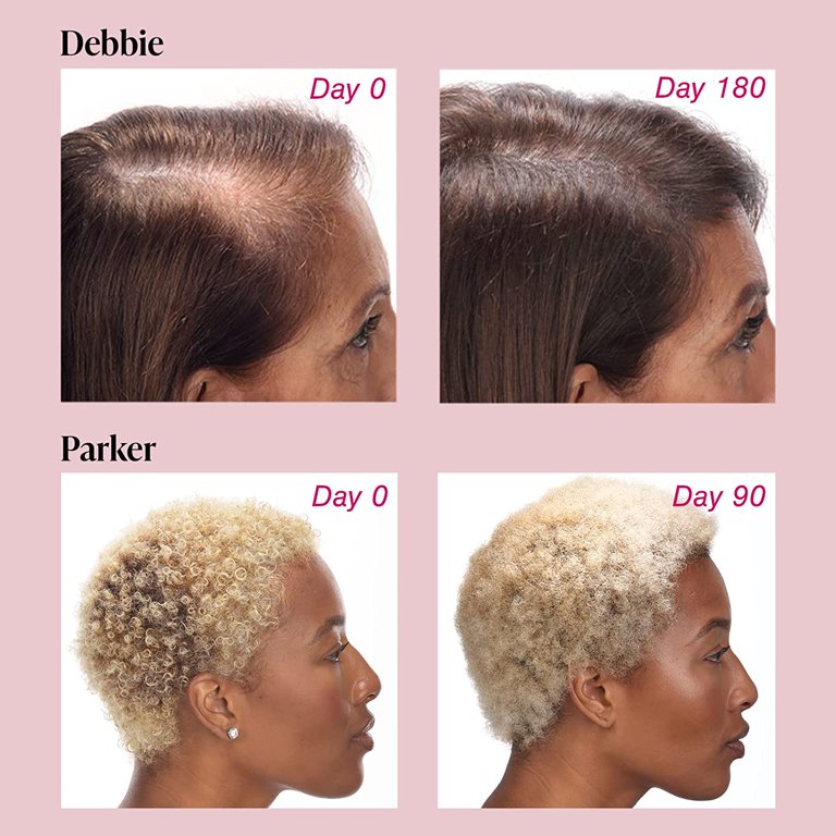 viviscal-promotes-existing-hair-growth