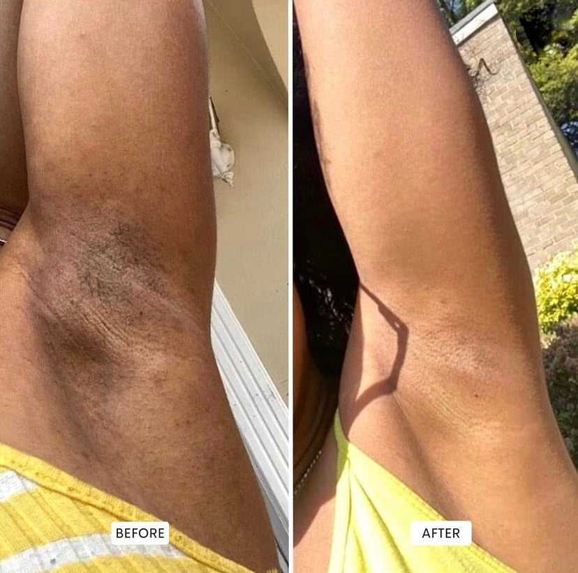 pfb-vanish-serum-eclaircissant-et-post-epilatoire-ultra-triple-action