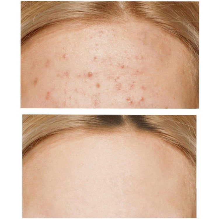 some-by-mi-aha-bha-pha-30-days-miracle-cream-60g