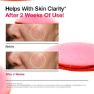 ANUA Niacinamide 10% + TXA 4% Dark Spot Correcting Serum 30ml masques