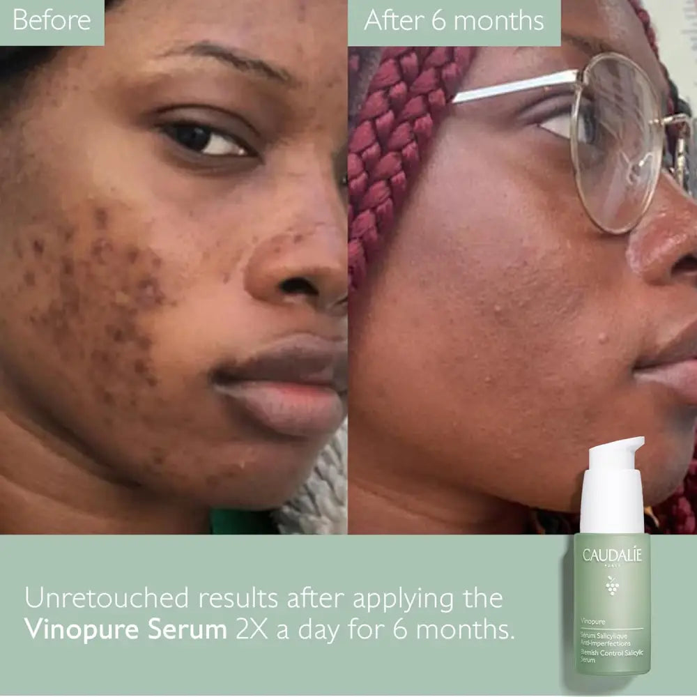 CAUDALIE Vinopure Sérum salicylique anti imperfections 30ml