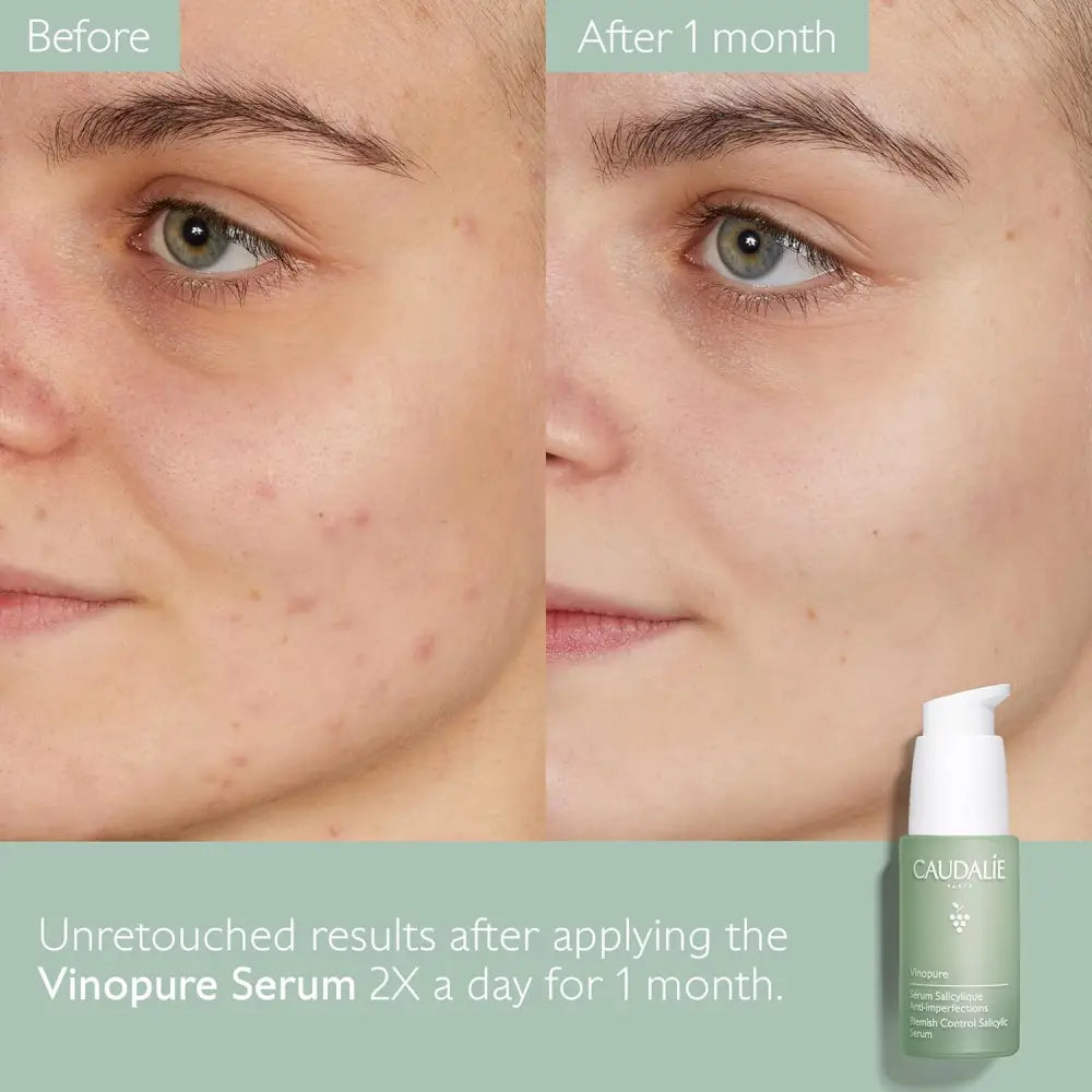 CAUDALIE Vinopure Sérum salicylique anti imperfections 30ml