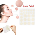 cosrx-acne-pimple-master-patch-24-pcs