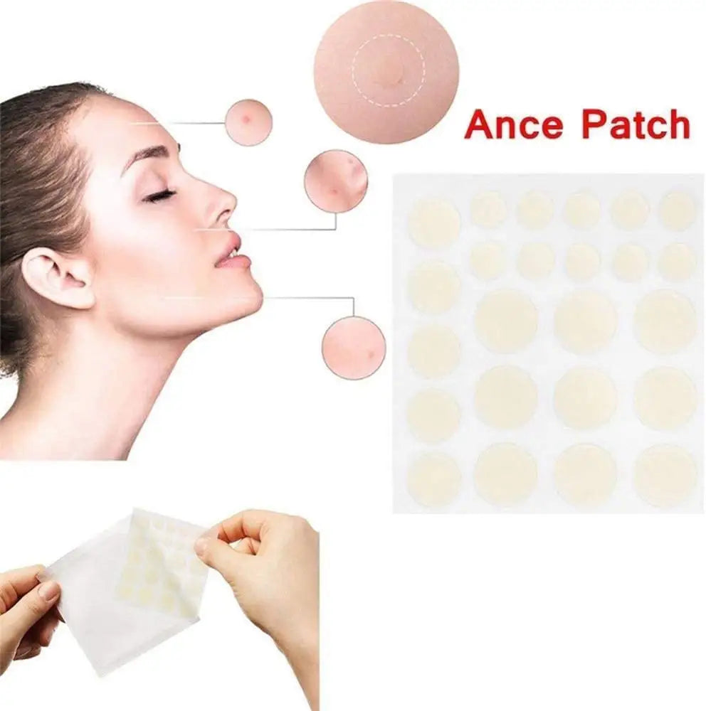 cosrx-acne-pimple-master-patch-24-pcs
