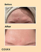 cosrx-essance-a-la-mucine-descargot-advanced-snail-96-mucine-power-100ml