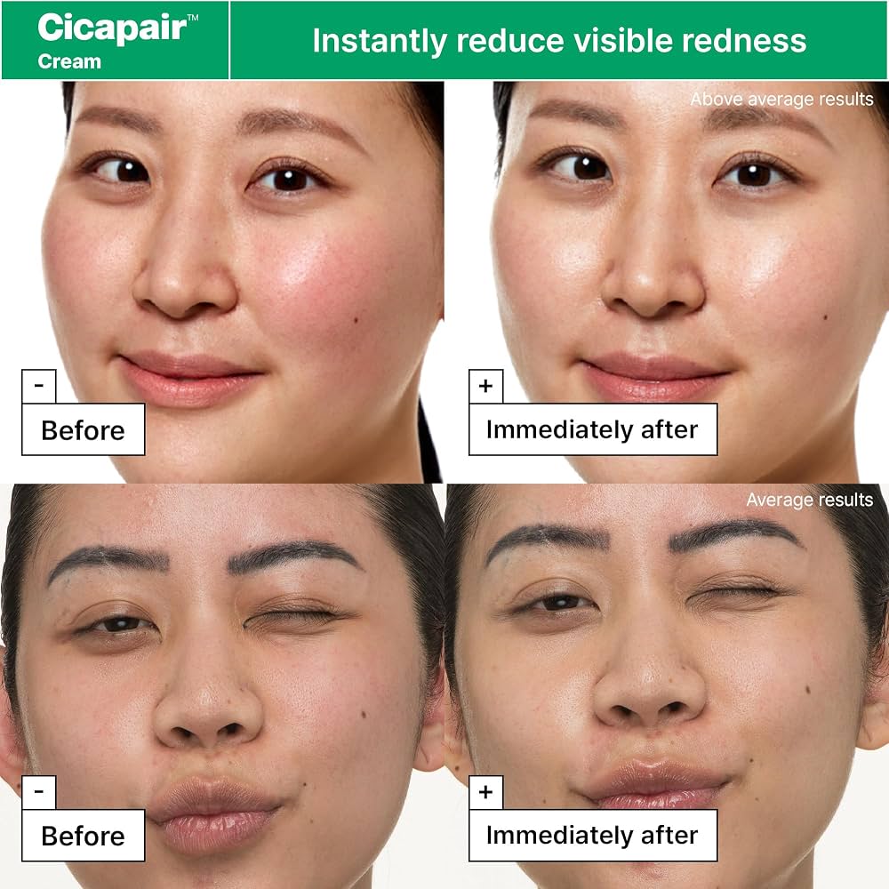 DR.JART+ - Cicapair Coffret Routine Rescue Anti-Rougeurs à la Centella Asiatica