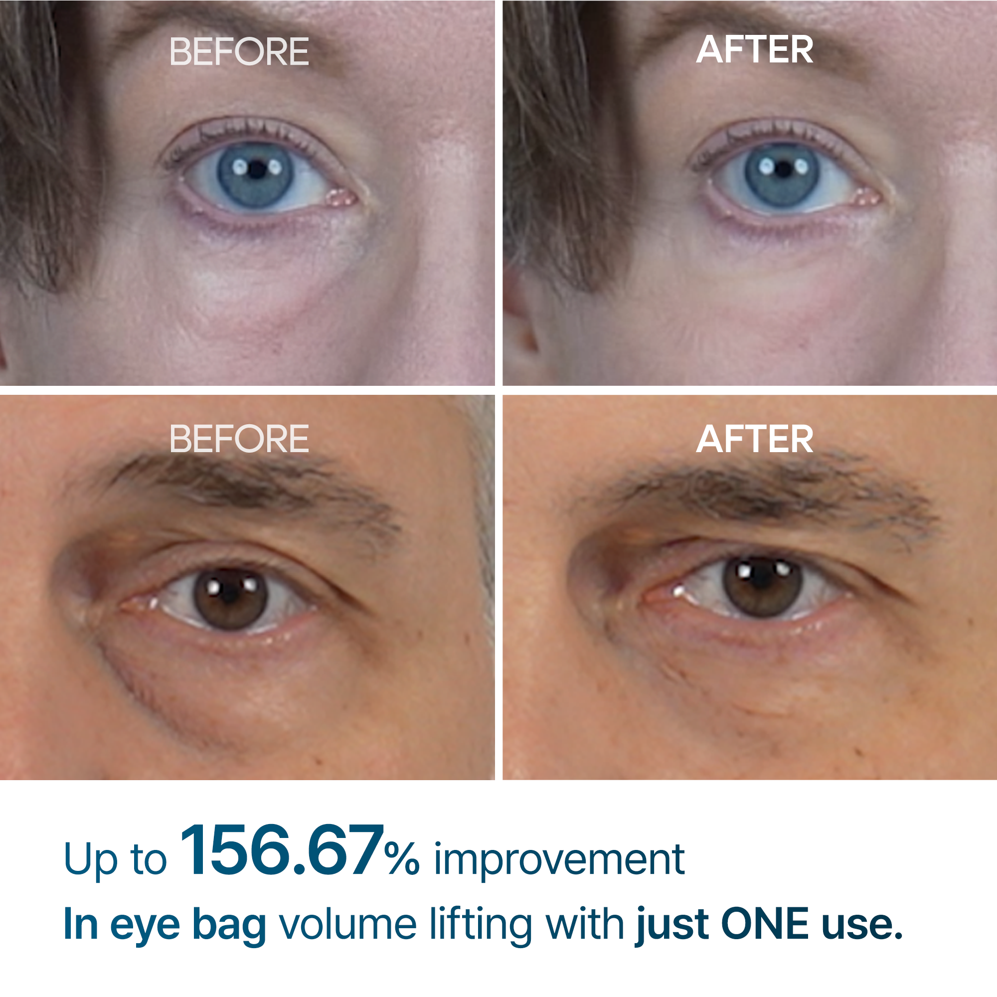 Dr MELAXIN -Eyephalt Eyebag Cream -10g