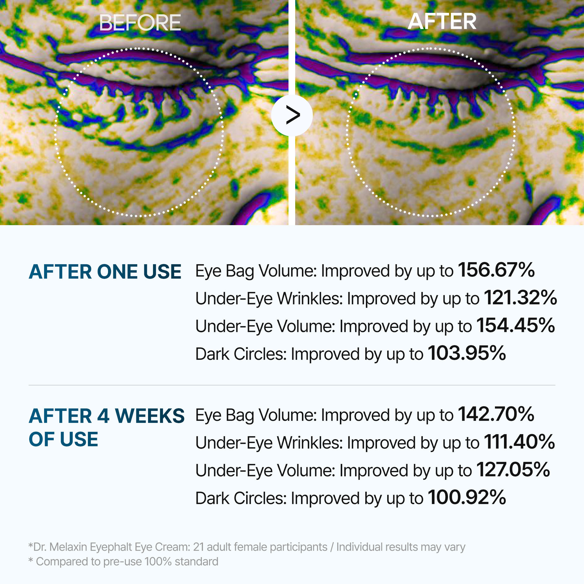 Dr MELAXIN -Eyephalt Eyebag Cream -10g