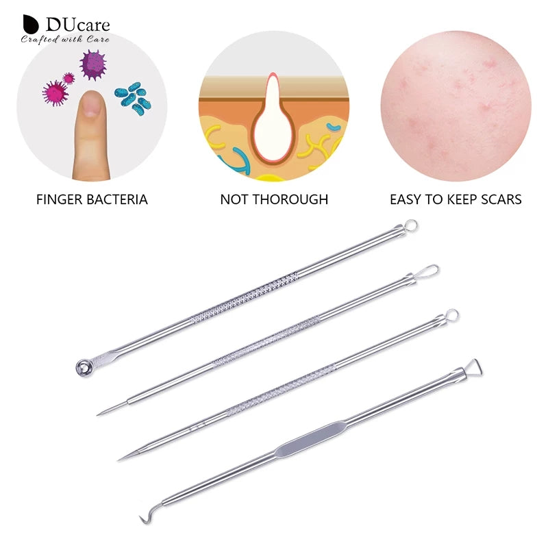 ducare-set-daiguilles-pour-eliminer-les-bouttons-4-pieces