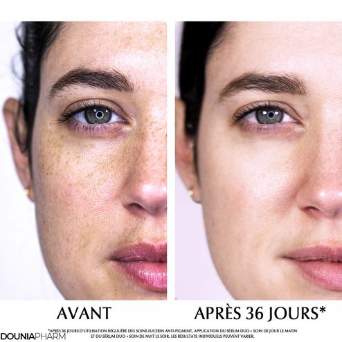 leucerin-anti-pigment-serum-duo-50ml