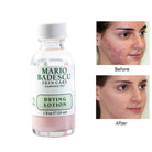 mario-badescu-drying-lotion-29ml-anti-acne-serum