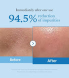 MEDICUBE - DUO Double Cleansing Zero Foam Cleanser + Zero Pore Blackhead Deep Cleansing Oil (2pcs) masques