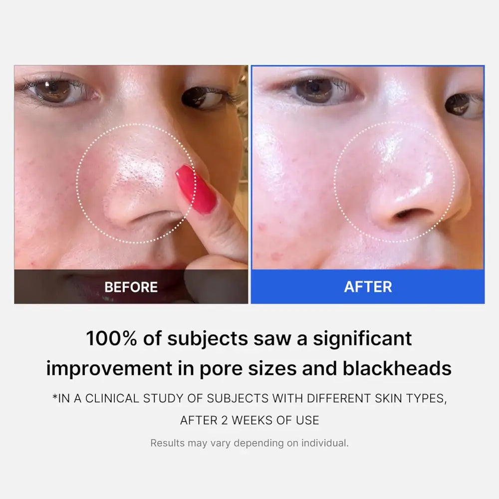 MEDICUBE Zero Pore Pad 2.0 70 pads masques