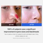 MEDICUBE Zero Pore Pad 2.0 70 pads masques