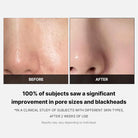 MEDICUBE Zero Pore Pad 2.0 70 pads masques