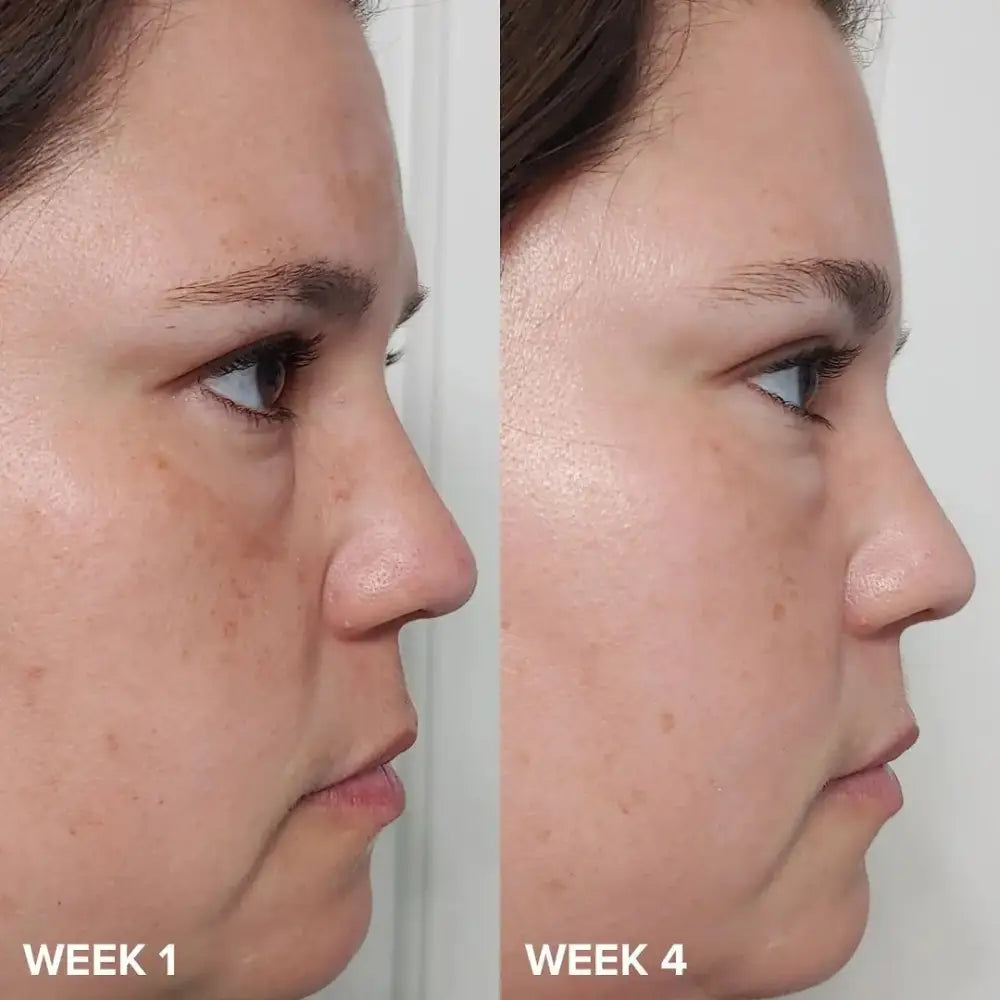 paulas-choice-mini-skin-perfecting-2-bha-lotion-exfoliante-30-ml