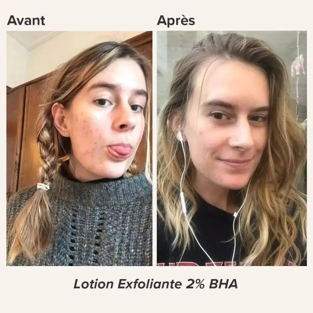 paulas-choice-mini-skin-perfecting-2-bha-lotion-exfoliante-30-ml