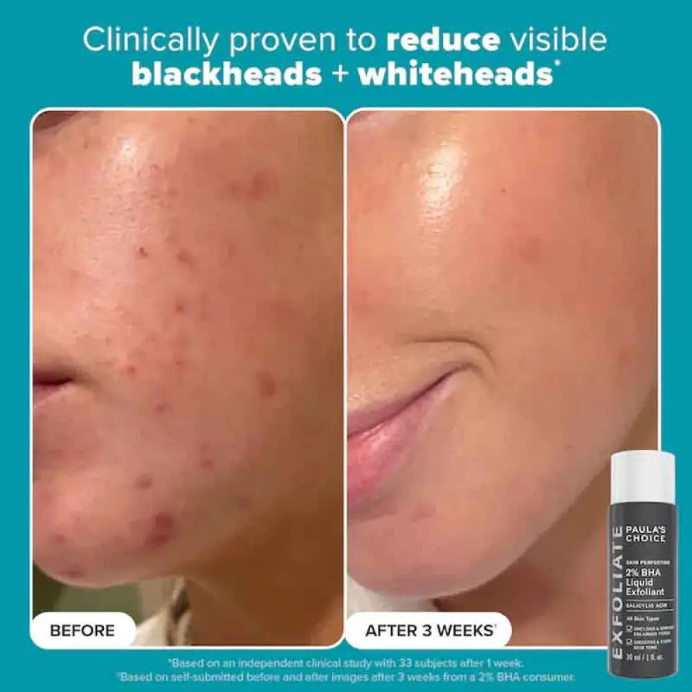 PAULA’S CHOICE - The Exfoliation Icons Kit MINI (2pcs) masques