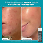 PAULA’S CHOICE - The Exfoliation Icons Kit MINI (2pcs) masques