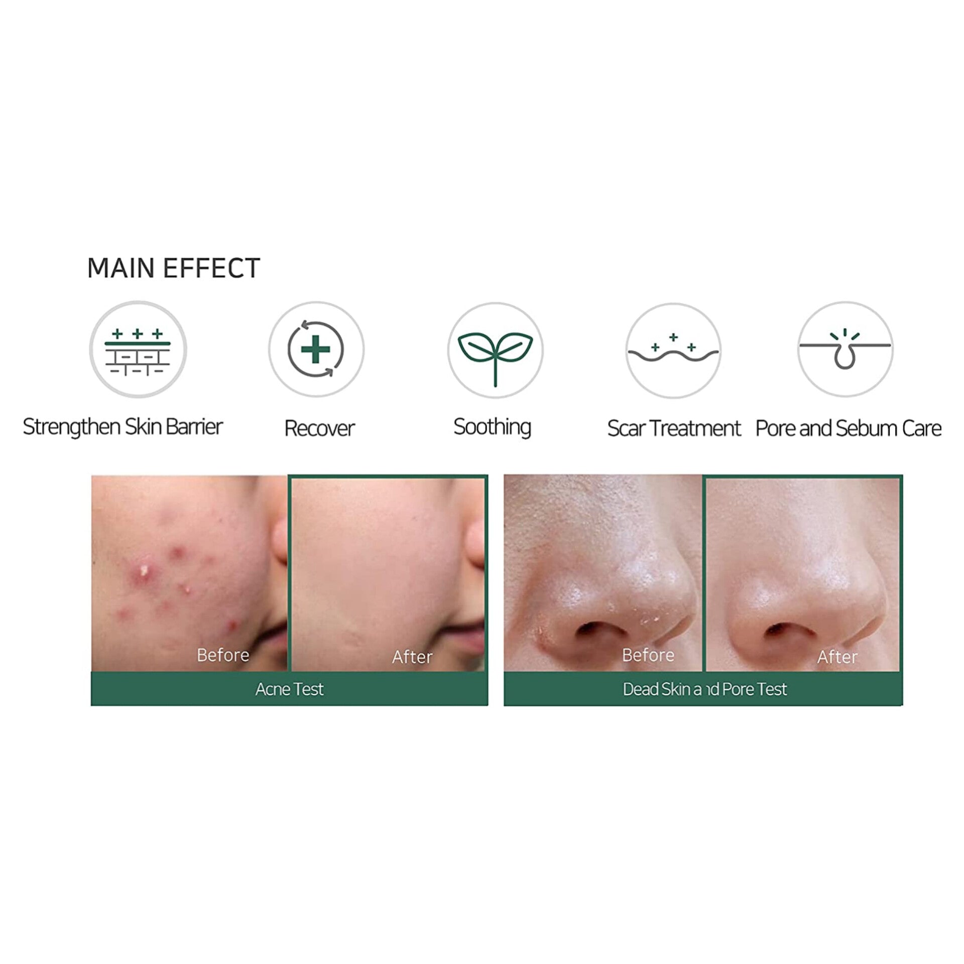 some-by-mi-aha-bha-pha-30-days-miracle-cream-60g