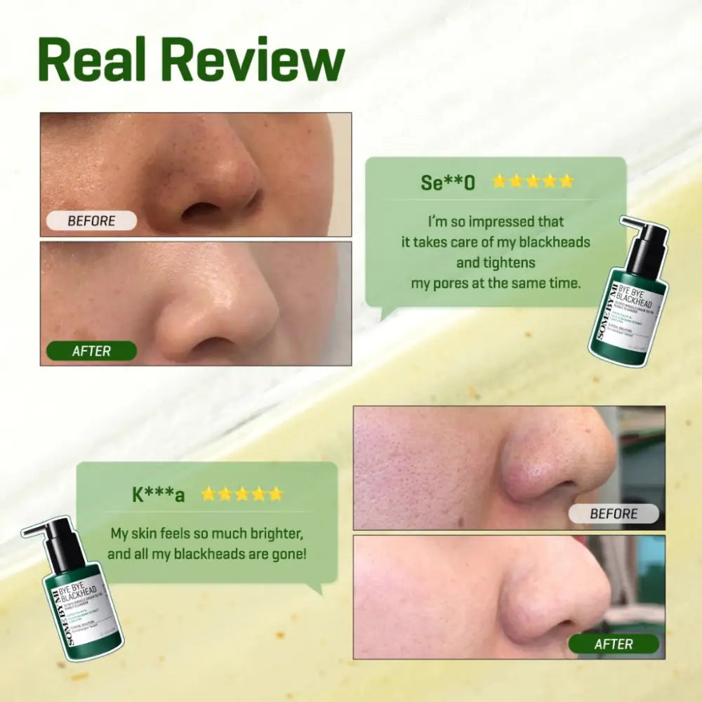 SOME BY MI Bye Bye Blackhead 30 Days Miracle Green Tea Tox Mousse Exfoliante 120g