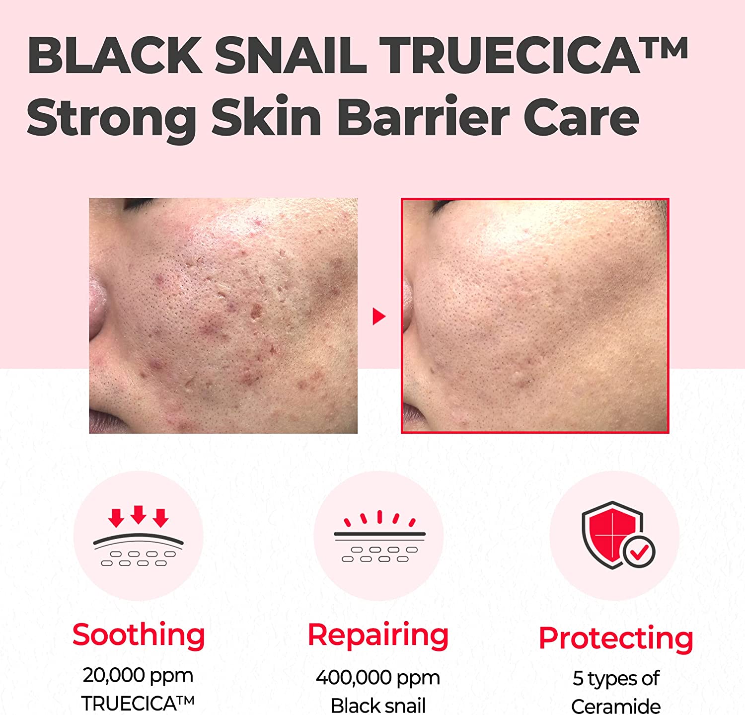 copy-of-some-by-mi-snail-truecica-miracle-cream-50ml