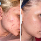 the-ordinary-hyaluronic-acid-2-b5