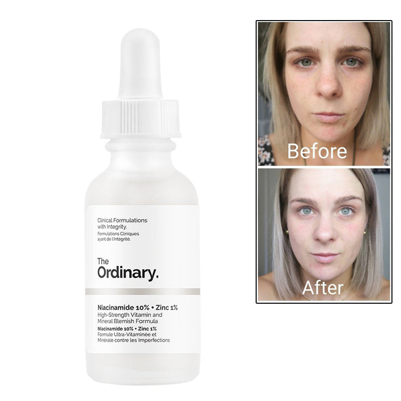 the-ordinary-niacinamide-10-zinc-1-60ml