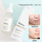 the-ordinary-niacinamide-10-zinc-1-60ml