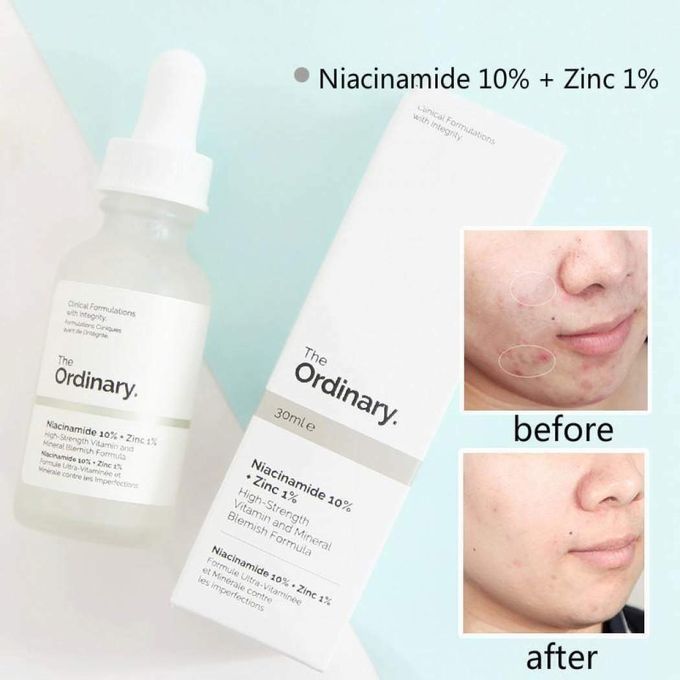 the-ordinary-niacinamide-10-zinc-1-60ml