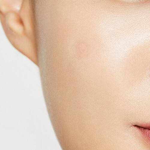 cosrx-acne-pimple-master-patch-24-patchs