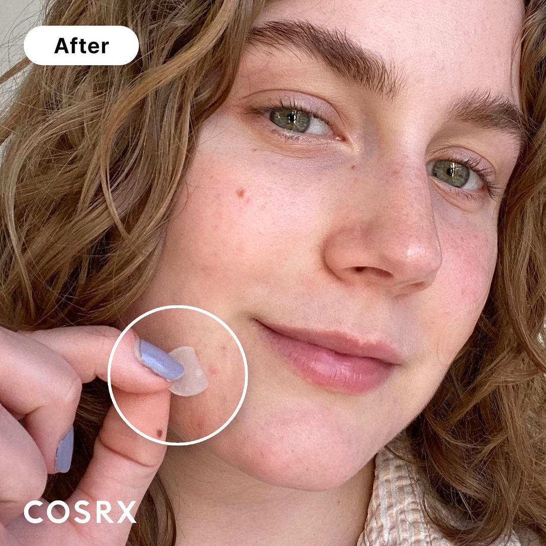 cosrx-acne-pimple-master-patch-24-pcs